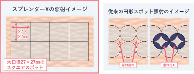 大きなスクエアで効率的に連続照射！