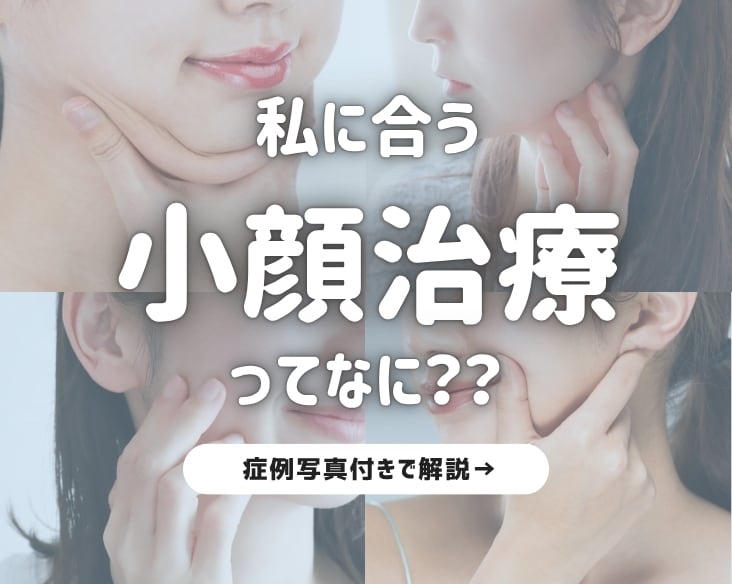 【お悩み別】小顔になる方法が一発でわかる！/ 新潟で小顔治療をするなら湘南美容クリニック長岡院