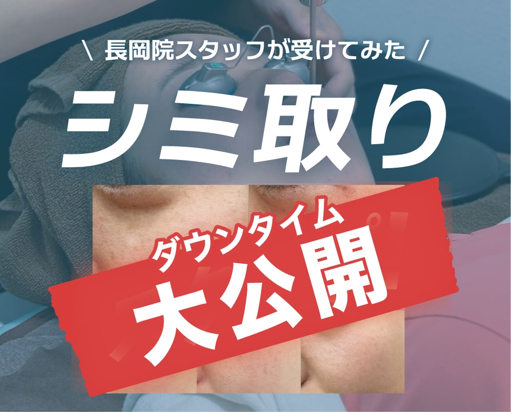 【新潟/長岡でシミ取り】気になるダウンタイム経過を大公開!/湘南美容クリニック長岡院