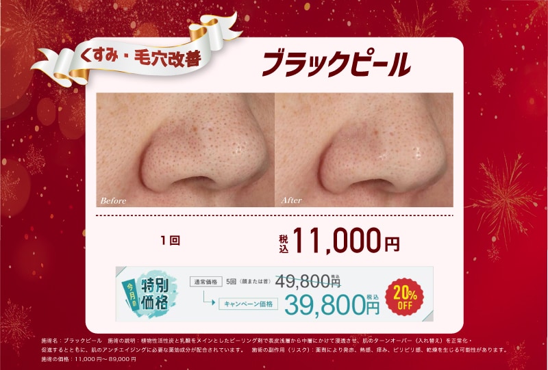 ブラックピール