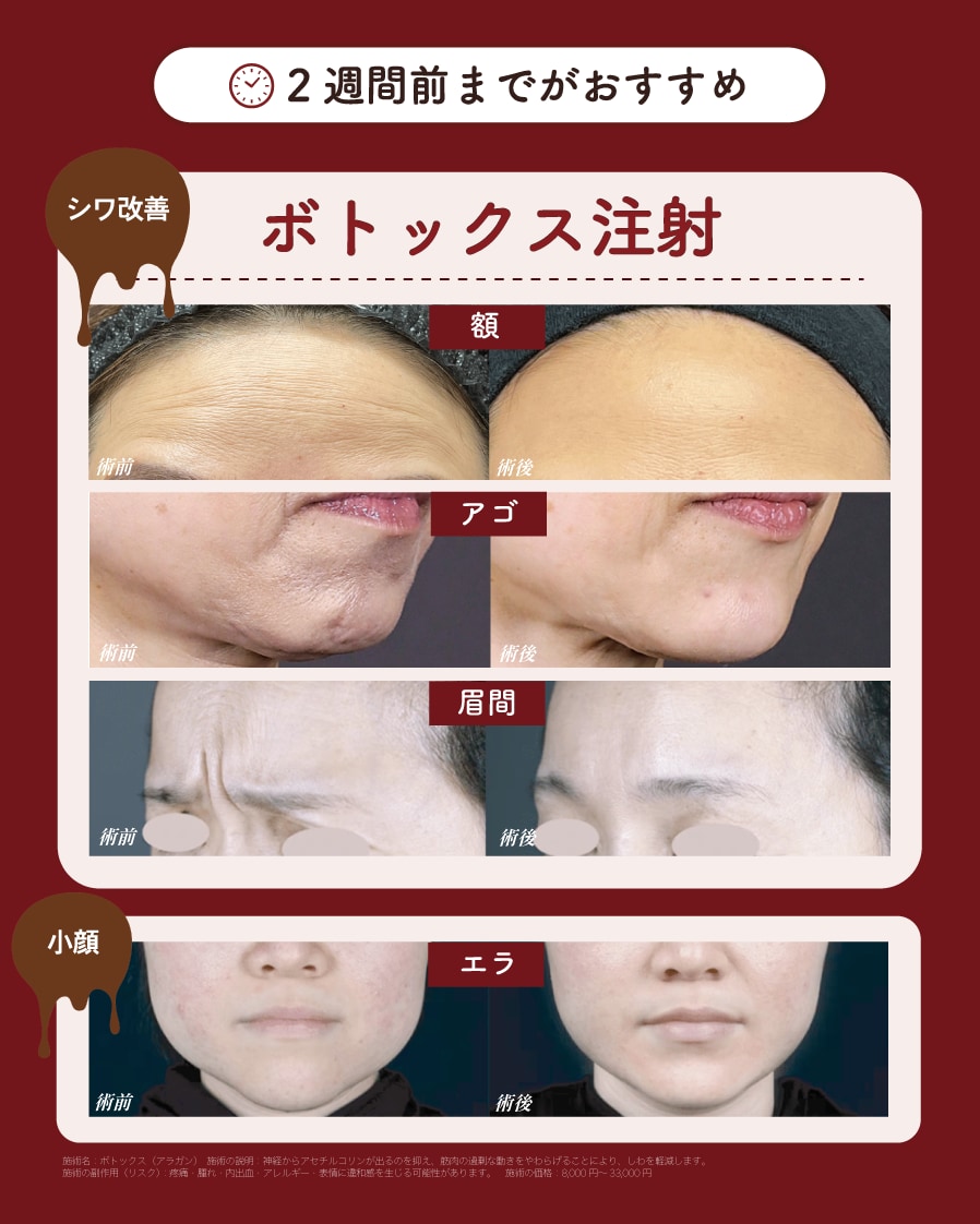 治療時間は短時間！