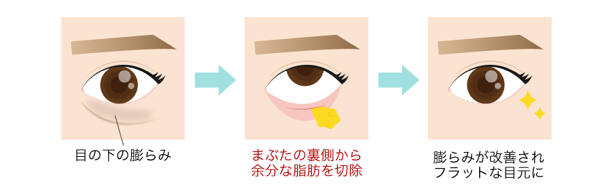 1回でしっかり効果を出したい方に