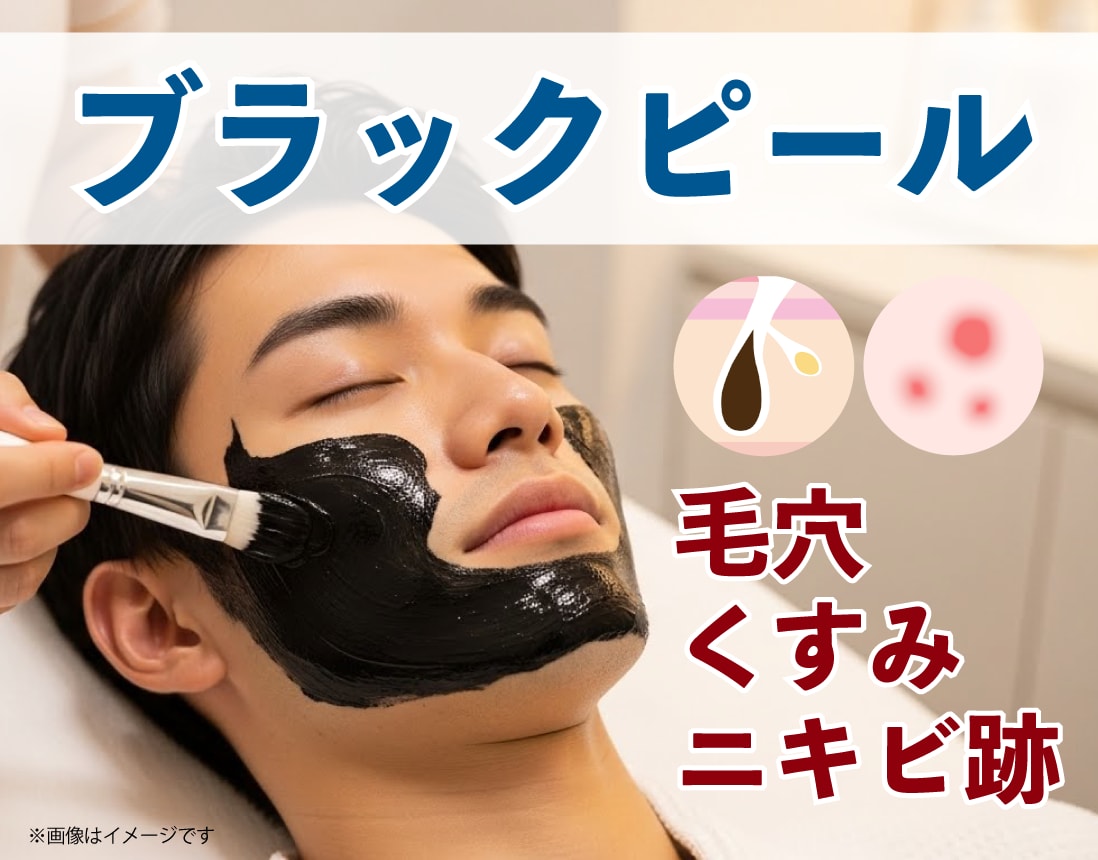 活性炭の力を利用したピーリング治療