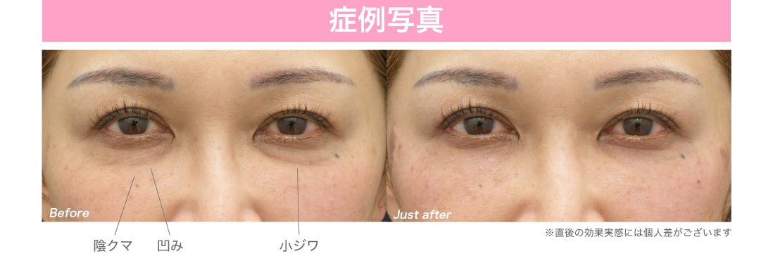 直後からわかる変化