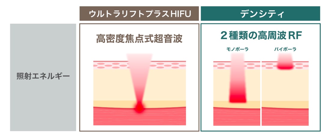 照射エネルギー