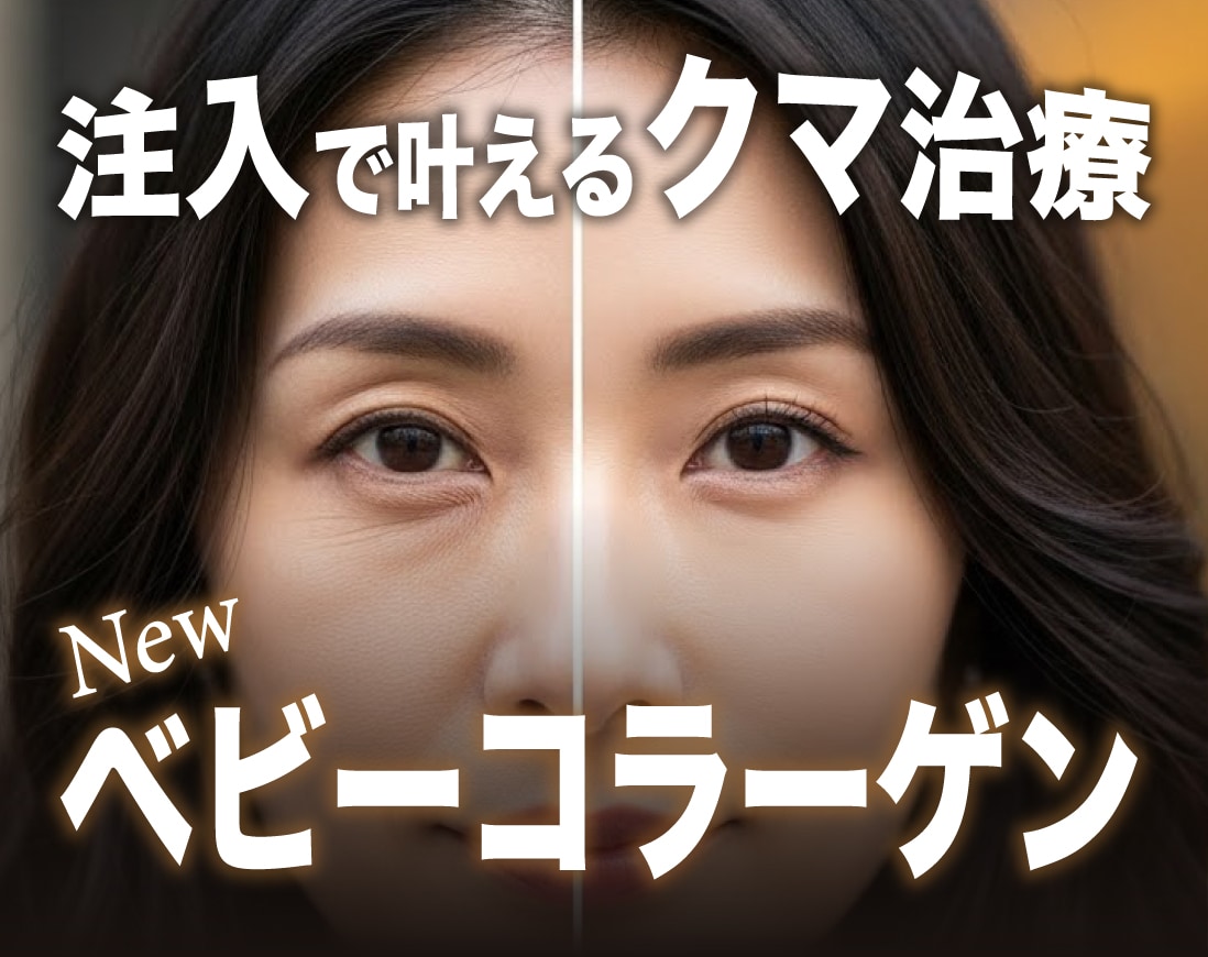 【直後から変わる】注入でクマ改善できるベビーコラーゲンとは？/湘南美容クリニック長岡院