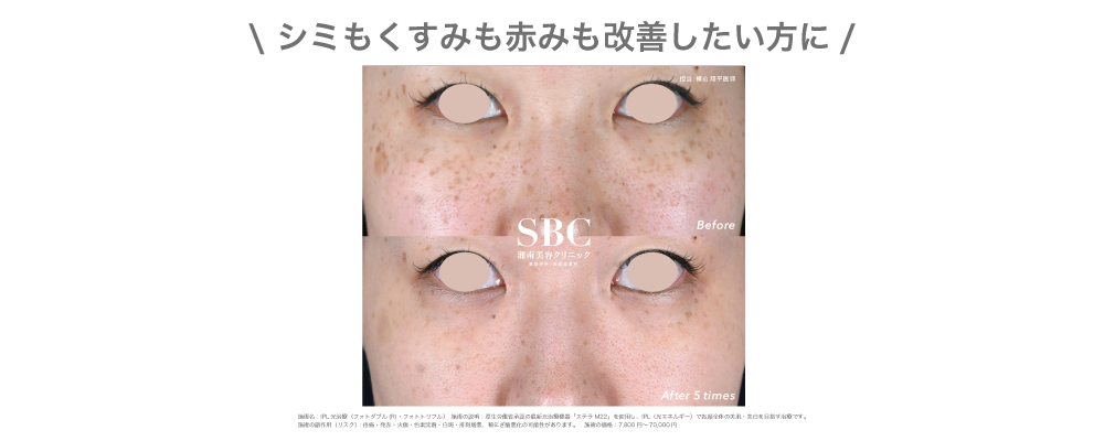 フォトトリプル