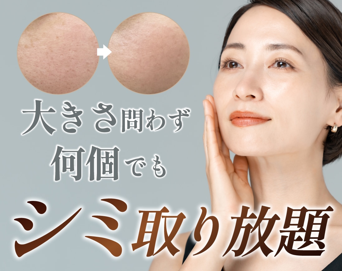 【新潟でシミ取り放題】49,800円で何個でも!どんな大きさでも!/ シミ治療なら湘南美容クリニック長岡院へ