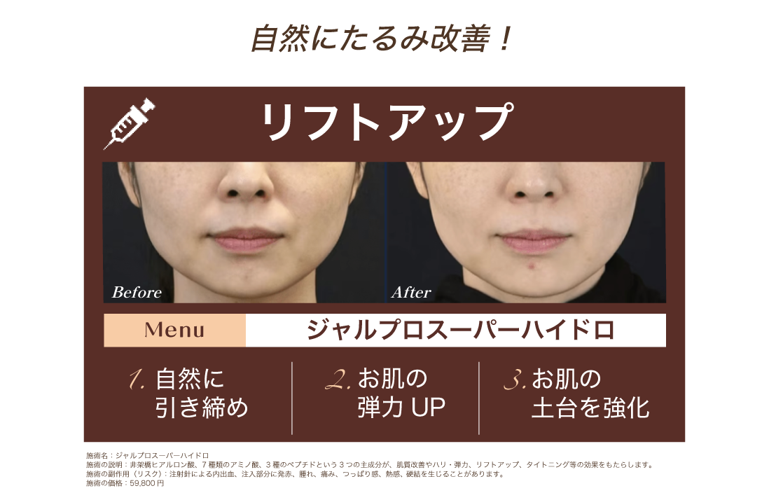 ジャルプロスーパーハイドロ