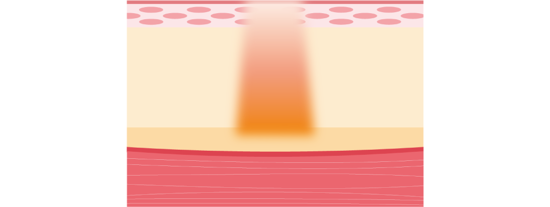 お肌にいい刺激を与える肌育治療