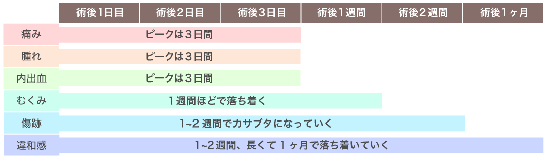 ダウンタイムは最小限