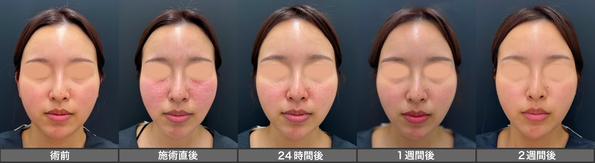 術前〜2週間後の変化