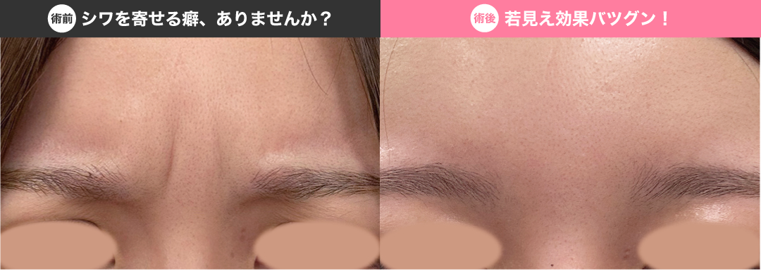 ふとした時にシワが寄ってしまっていませんか？