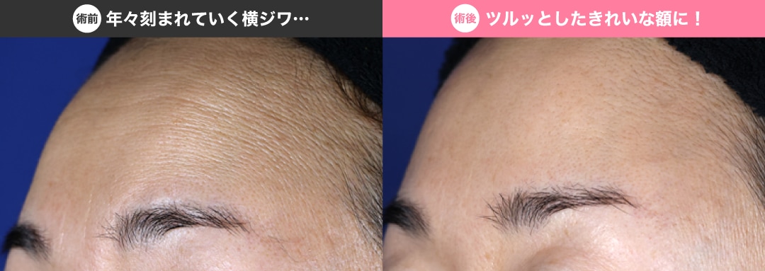 老け見えの原因に…