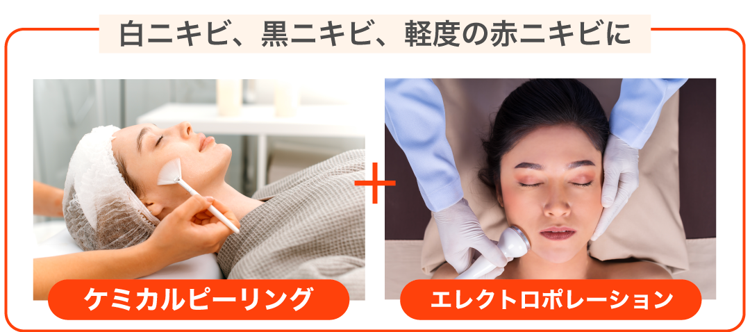 毛穴の詰まり、ザラつき、肌のくすみ、ニキビができやすい肌質に