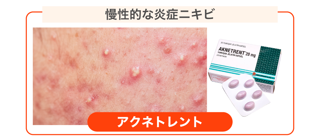 保険診療や外用薬でも全く治らない方に