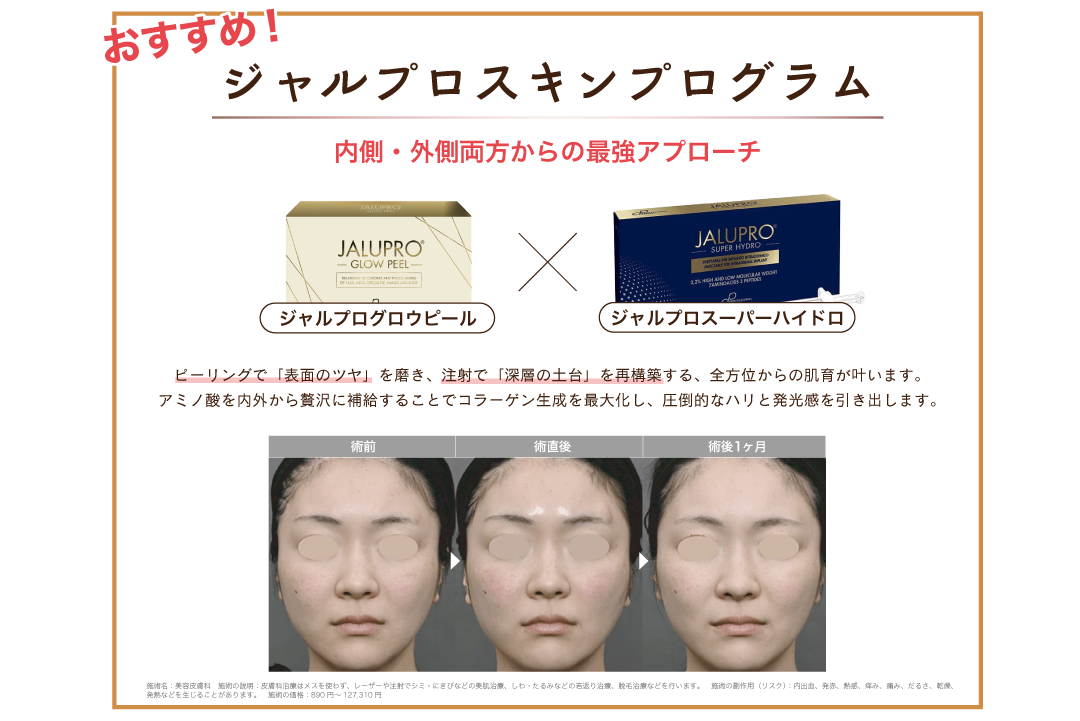 内側と外側の両方からアプローチ！