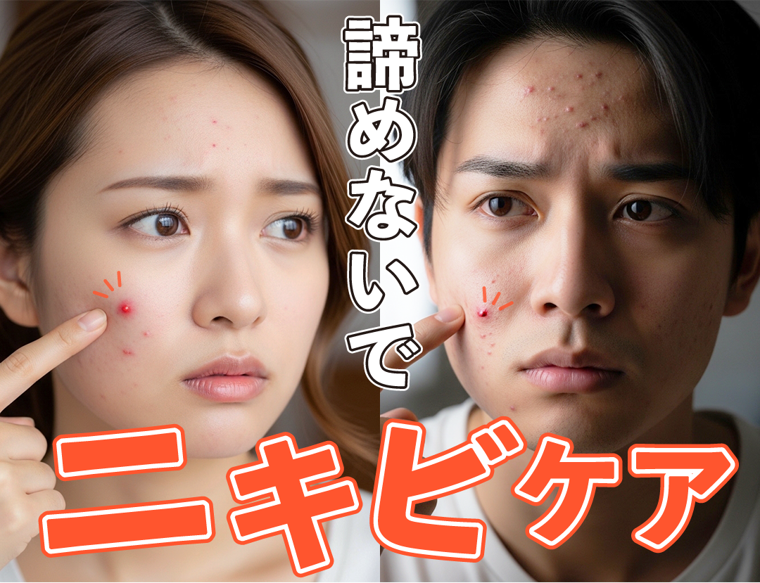 長岡でニキビ・ニキビ跡治療をするなら駅直結のSBC長岡院！