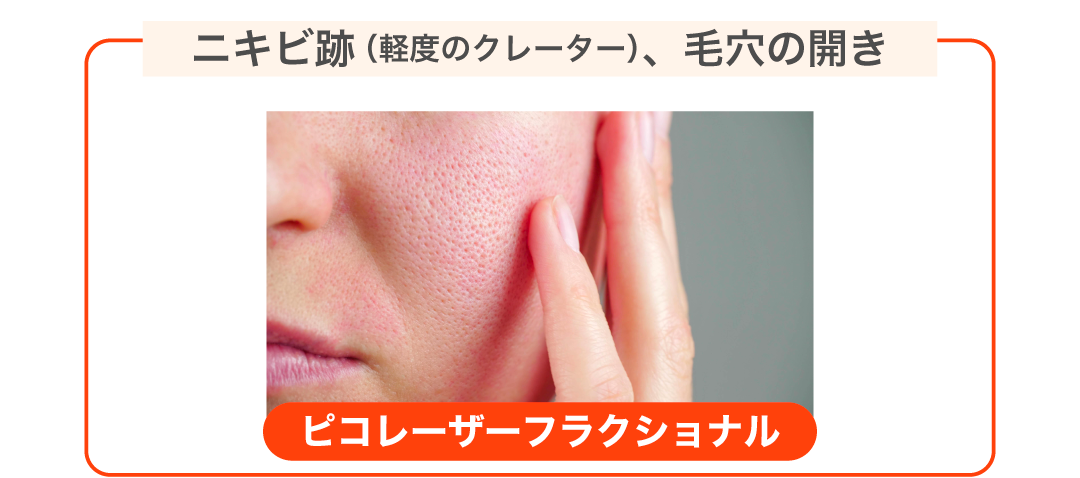 肌の表面をなめらかにしたい、毛穴を引き締めたい方に