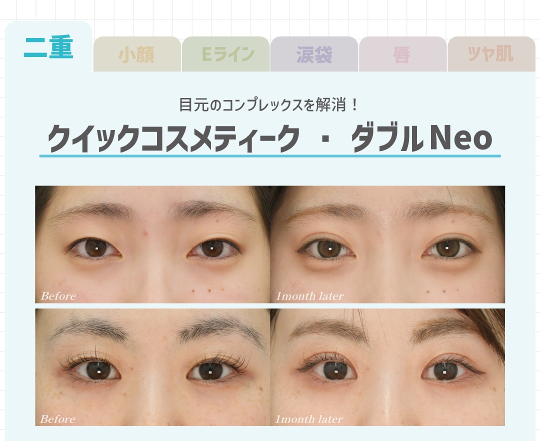 クイックコスメティーク・ダブルNeo