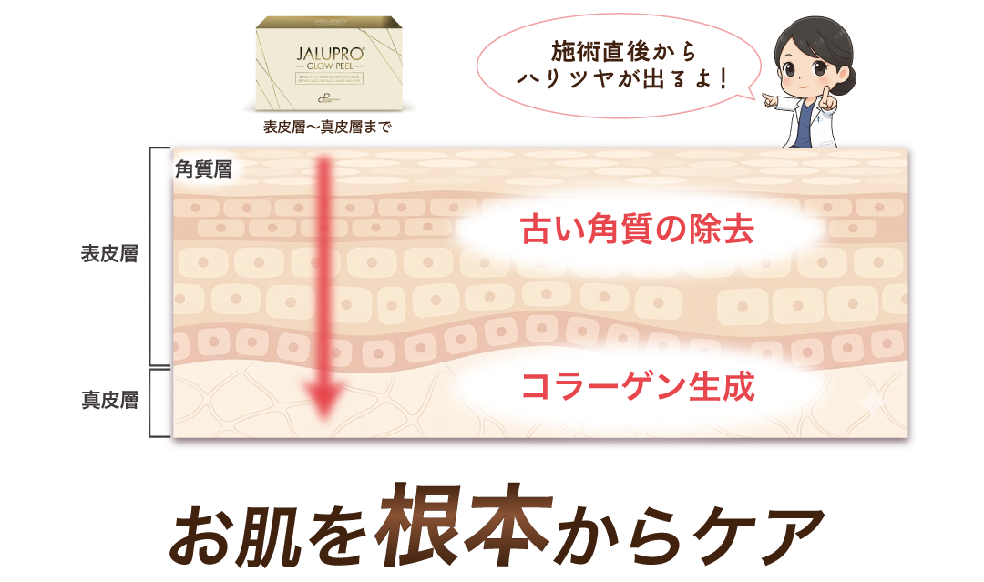 角質除去＋コラーゲン生成促進