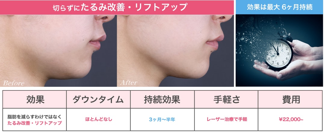 人気のたるみ治療