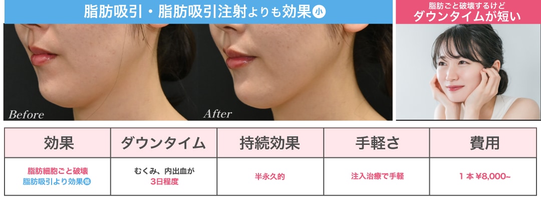 手軽な治療で脂肪細胞を破壊