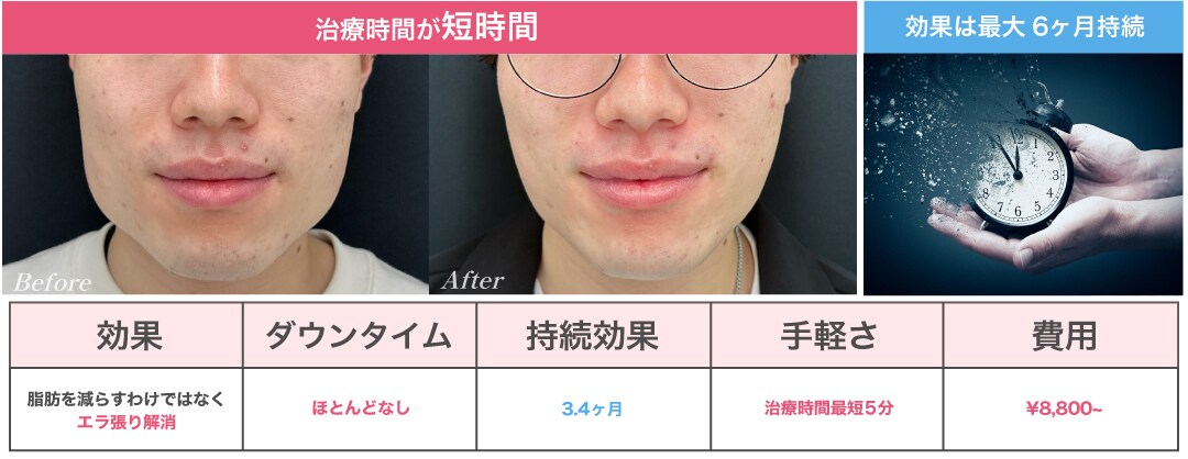 治療時間は最短5分！