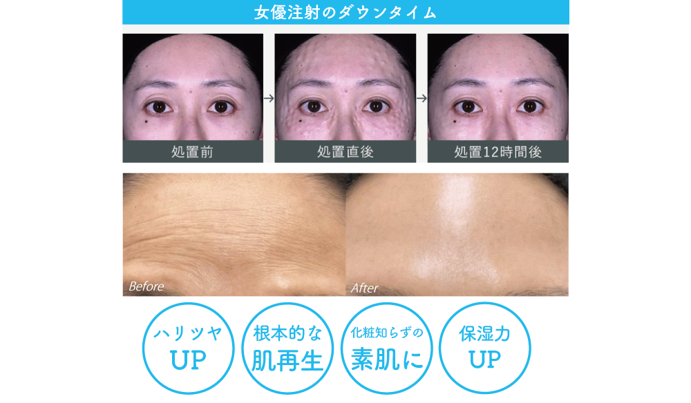 圧倒的なツヤ肌に