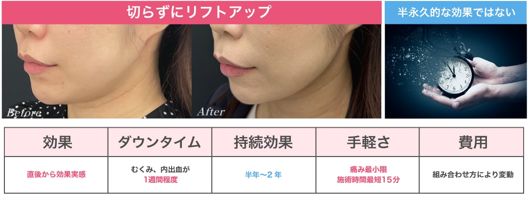 直後から引き上げ効果