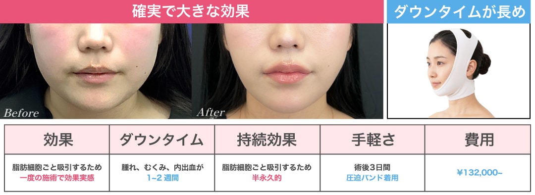 圧倒的な小顔効果