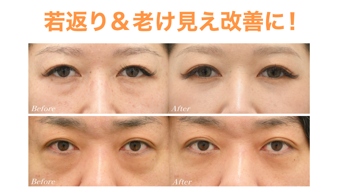 クマ治療