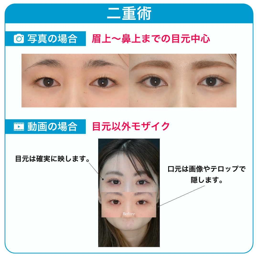 施術ごとに異なります。