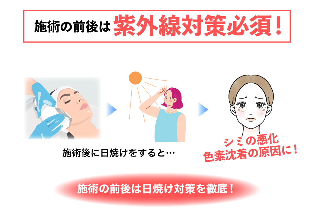 紫外線対策は美容施術の効果に影響する！？