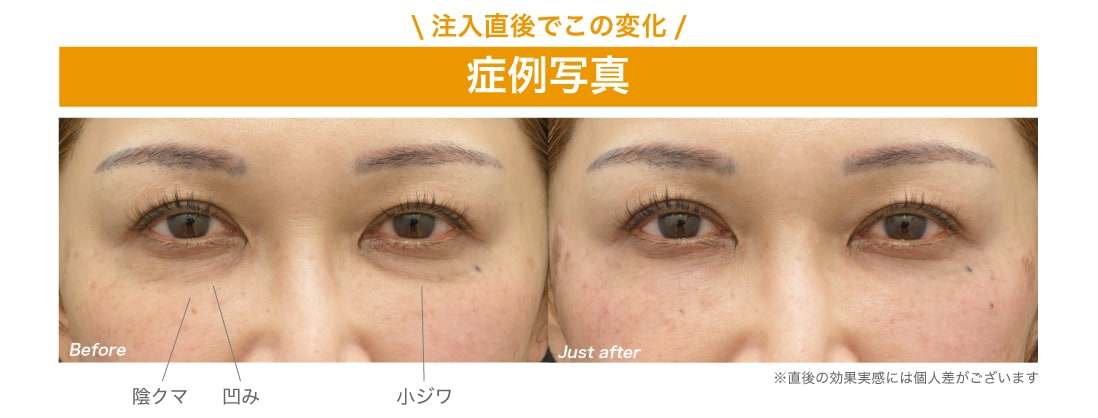 直後からわかる変化