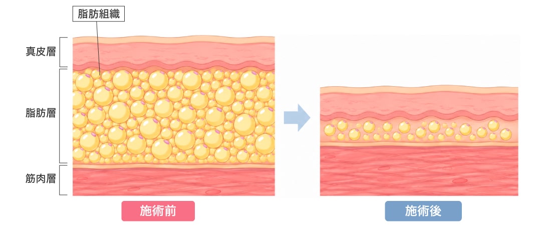 皮膚の引き締め効果