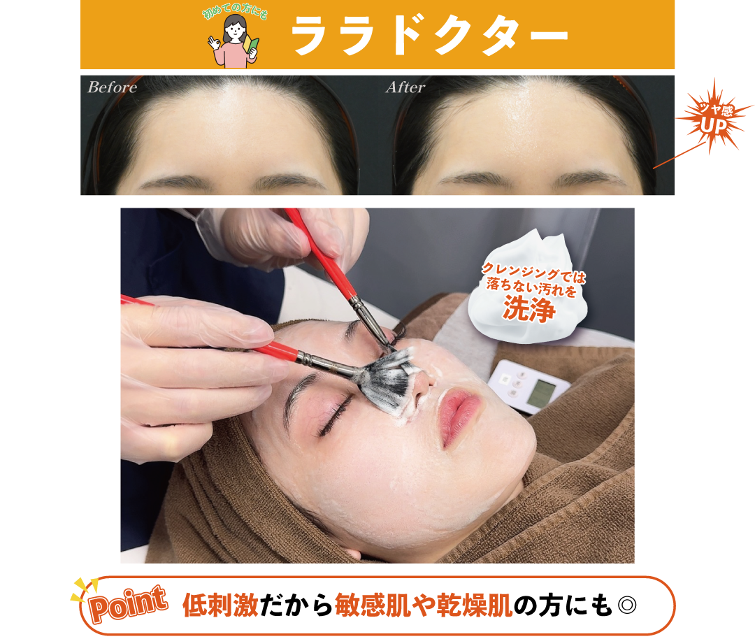 No.5|話題の医療機関専用ピーリングで毛穴もくすみも改善！