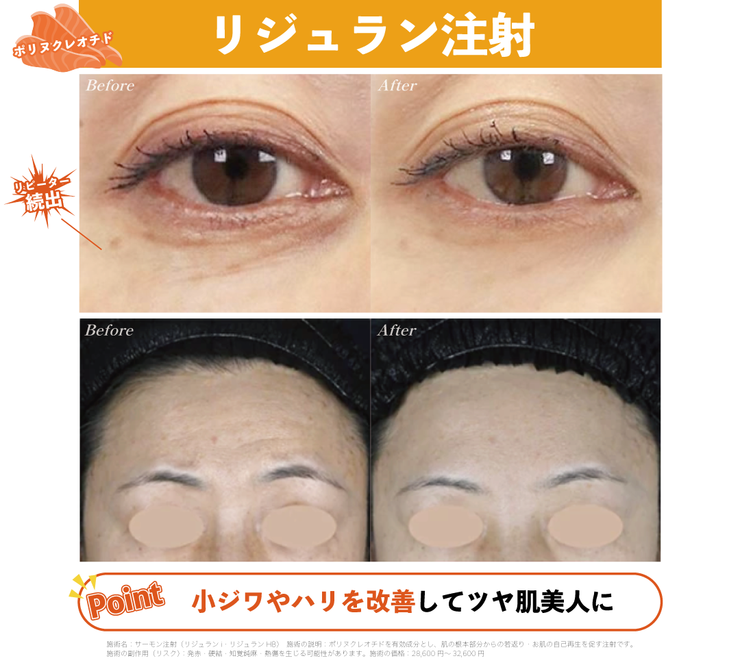 No.4|ツヤ肌美人になりたいあなたにはこれ！