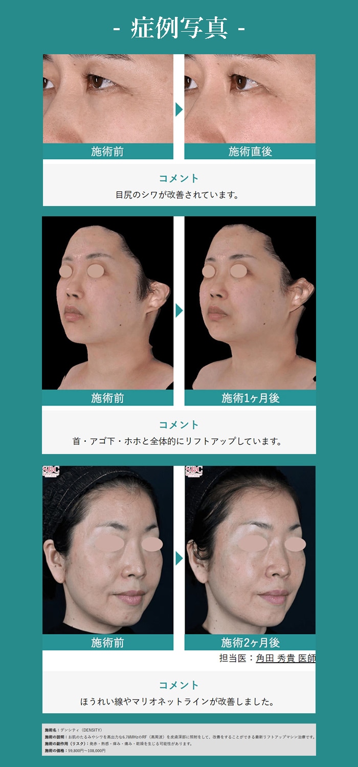 症例写真