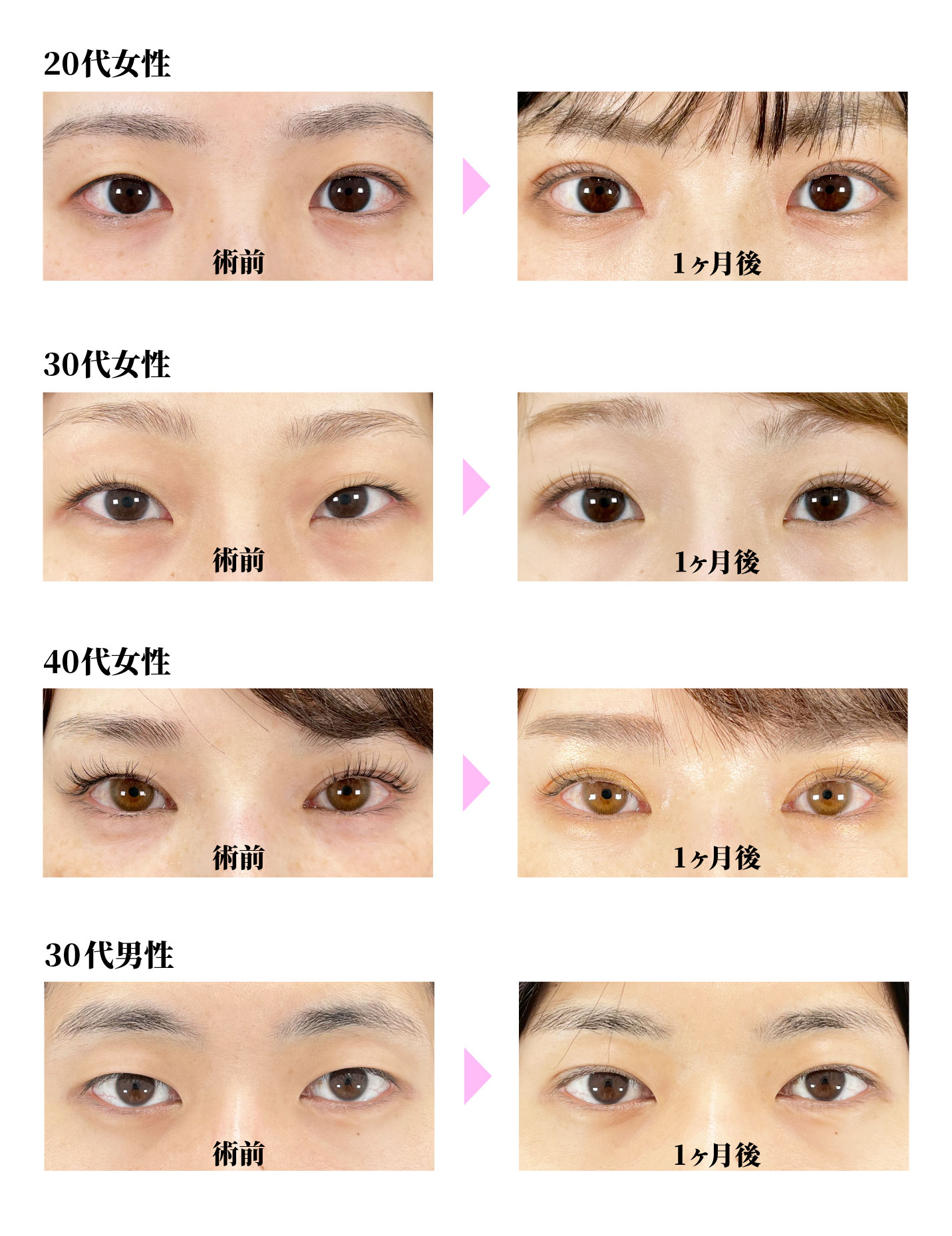 クイックコスメティーク・ダブルNeo