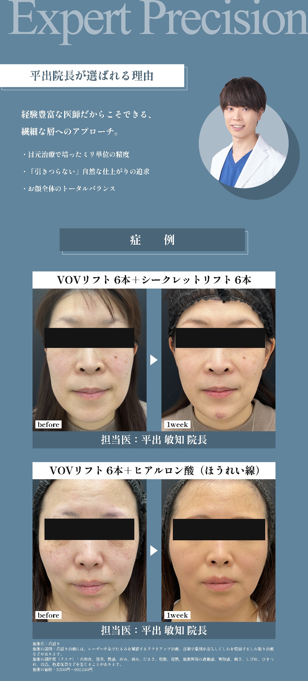 繊細な技術で叶える、違和感のない美しいフェイスライン
