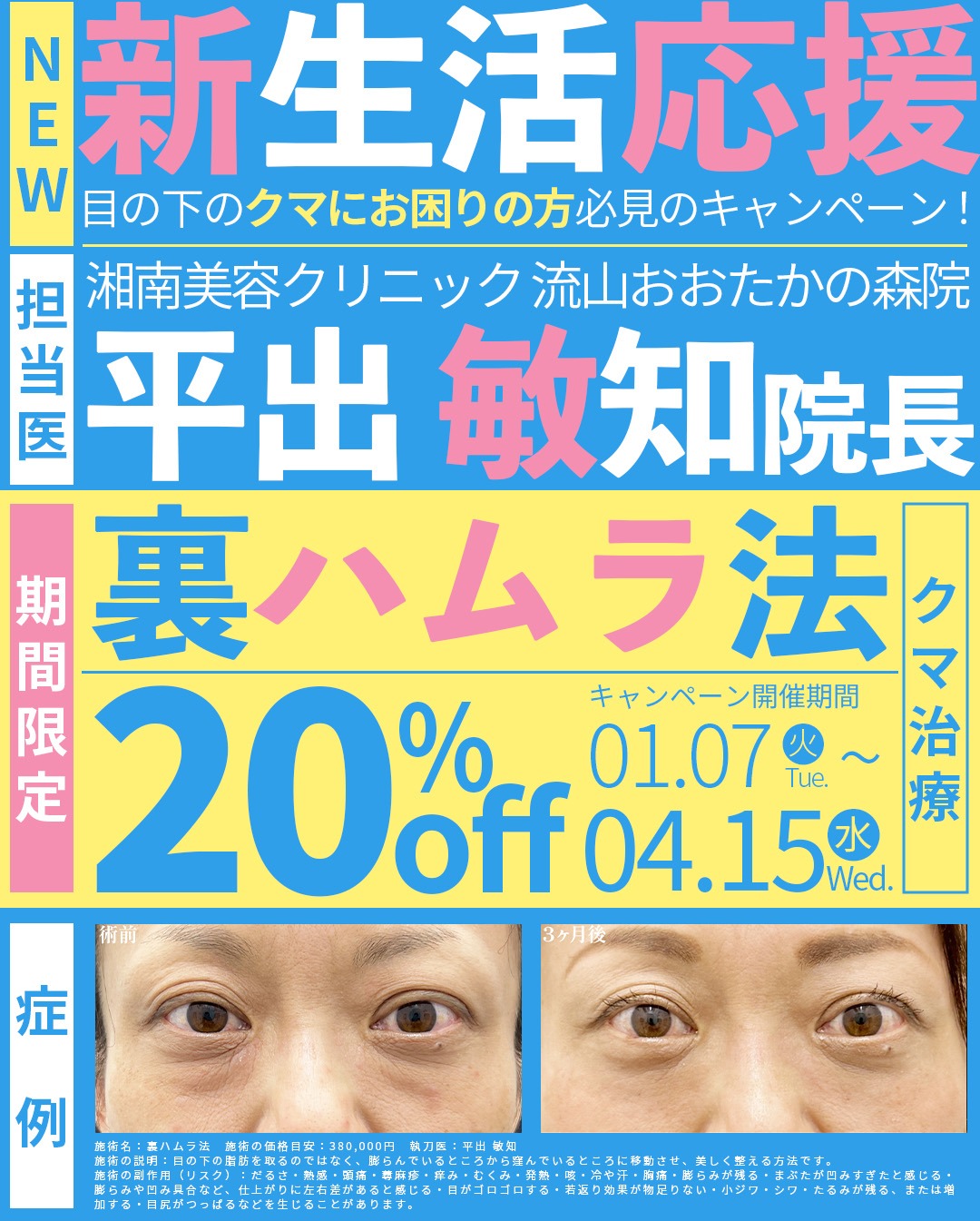 4/15まで限定！クマ取り20％off🎉