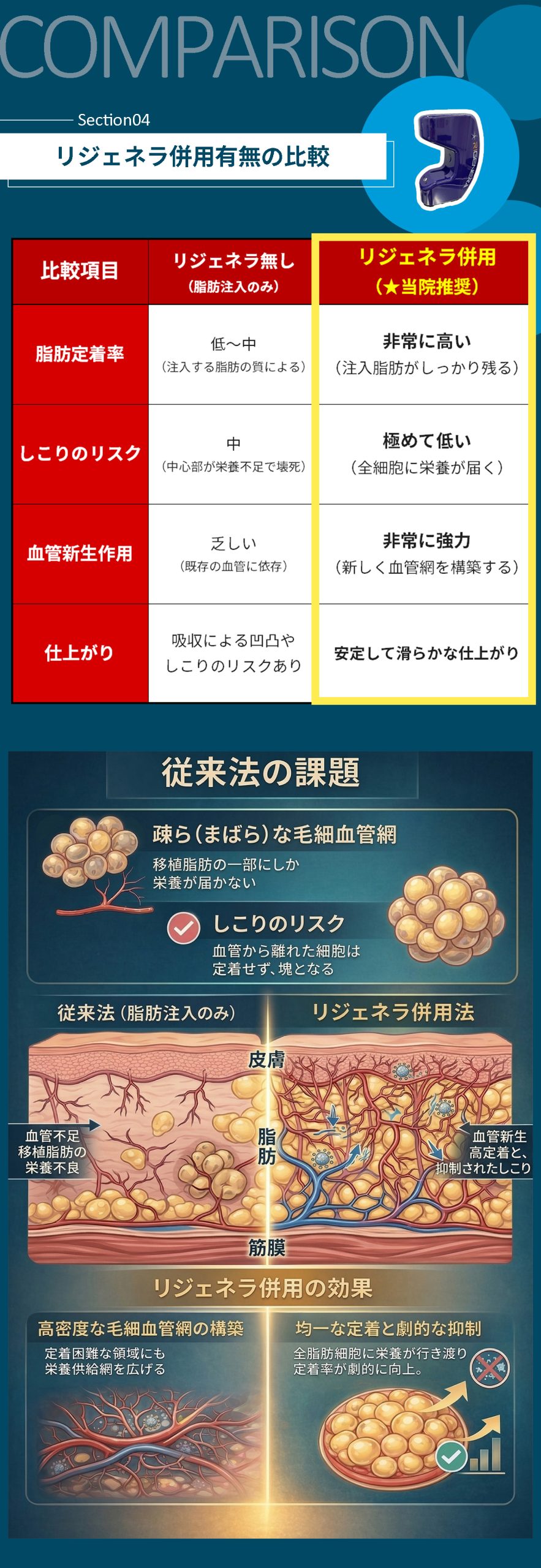 リジェネラ「有り」と「無し」での徹底比較