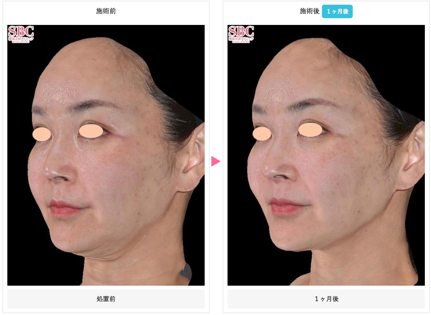 DENSITY（デンシティ）