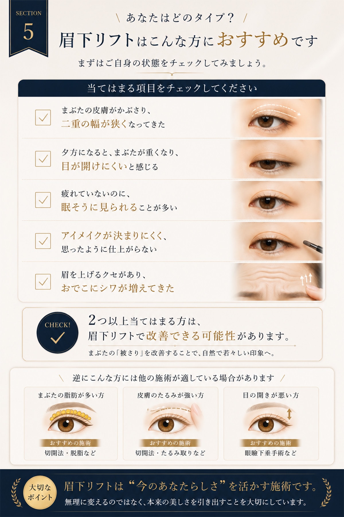 あなたの目元はどれに当てはまる？