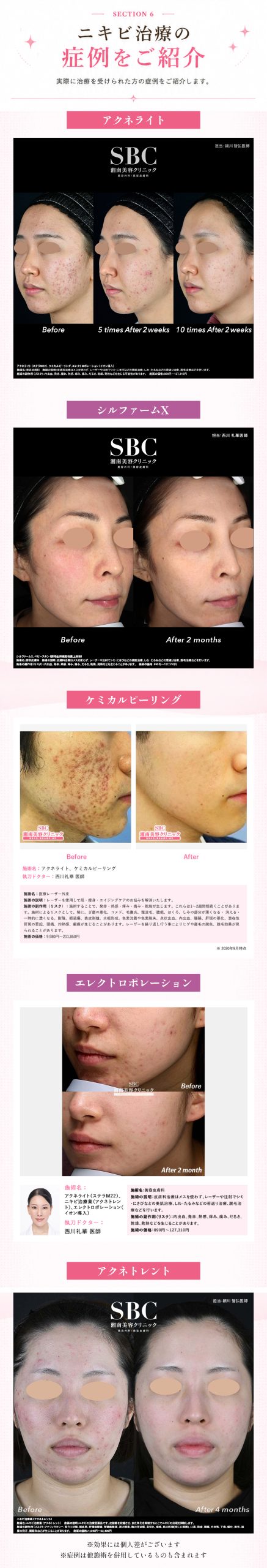 Before＆After
