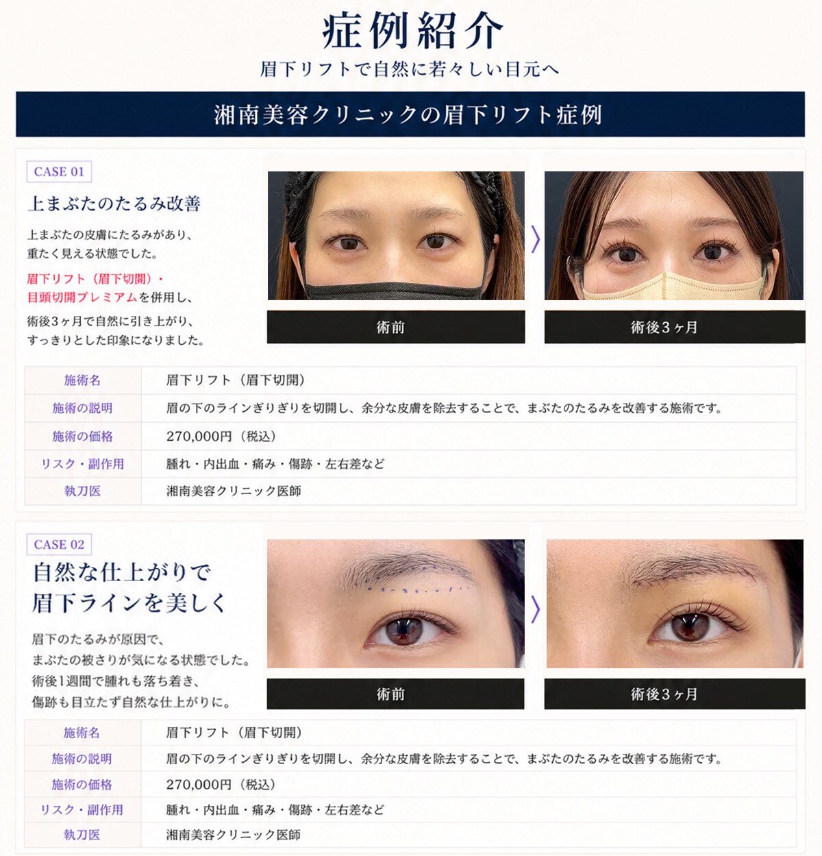 Before＆After
