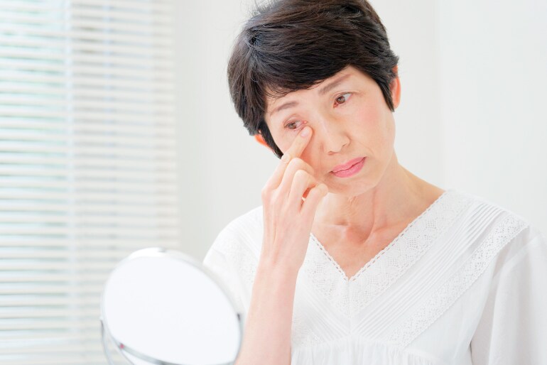 40代・50代以上：加齢による皮膚・筋肉の衰えと深いゴルゴ線