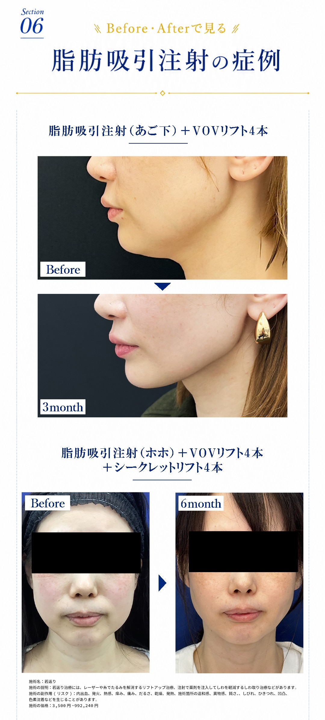 Before＆After