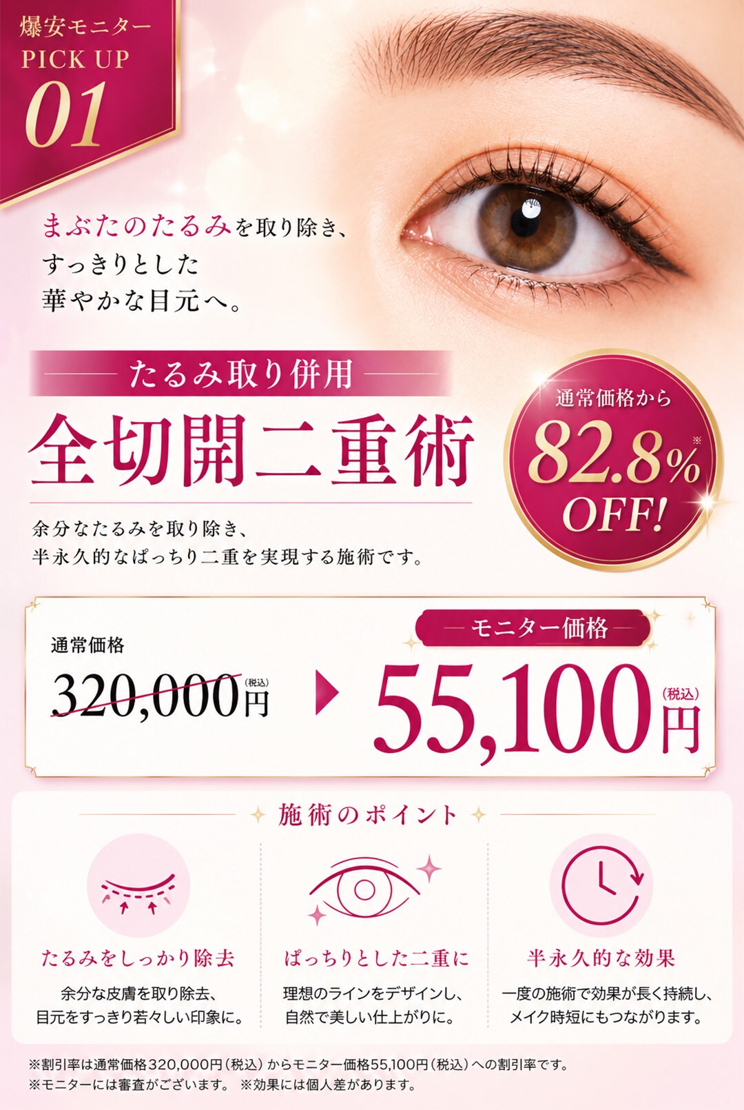 たるみ取り併用 全切開二重術